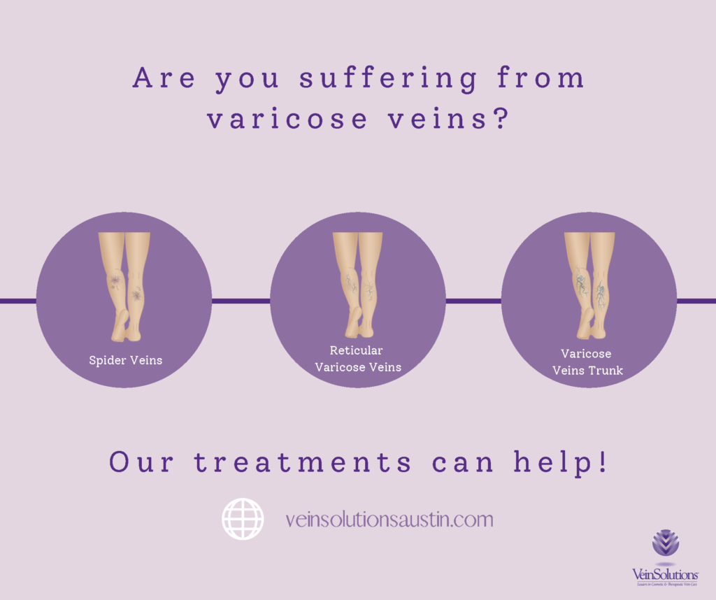 Which varicose vein treatment is right for me? VeinSolutions Austin Which varicose vein treatment is right for me? VeinSolutions Austin