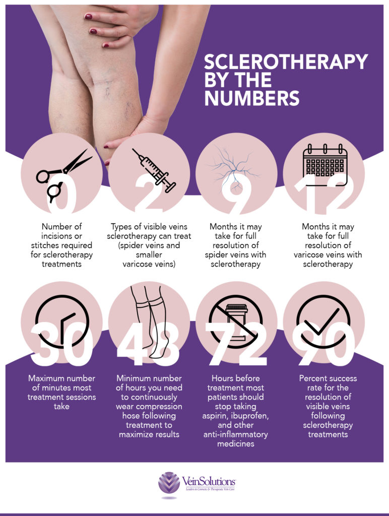 VeinSolutions Sclerotherapy Infographic